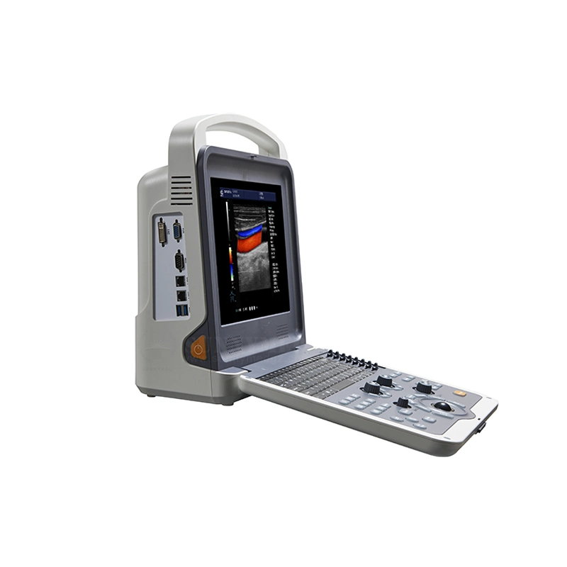 Sy-A042n Cheap Color Doppler Handy Baby Scanner Medical Digital Ultrasonography Ultrasound Machine Price