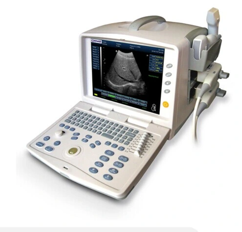 Hot Sale Full-Digital Portable B/W Ultrasound Scanner with Low Price