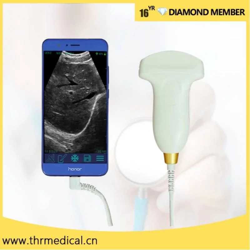 Handheld 80/128 Elements Wireless Ultrasound Machine Convex Probe (THR-USP1)