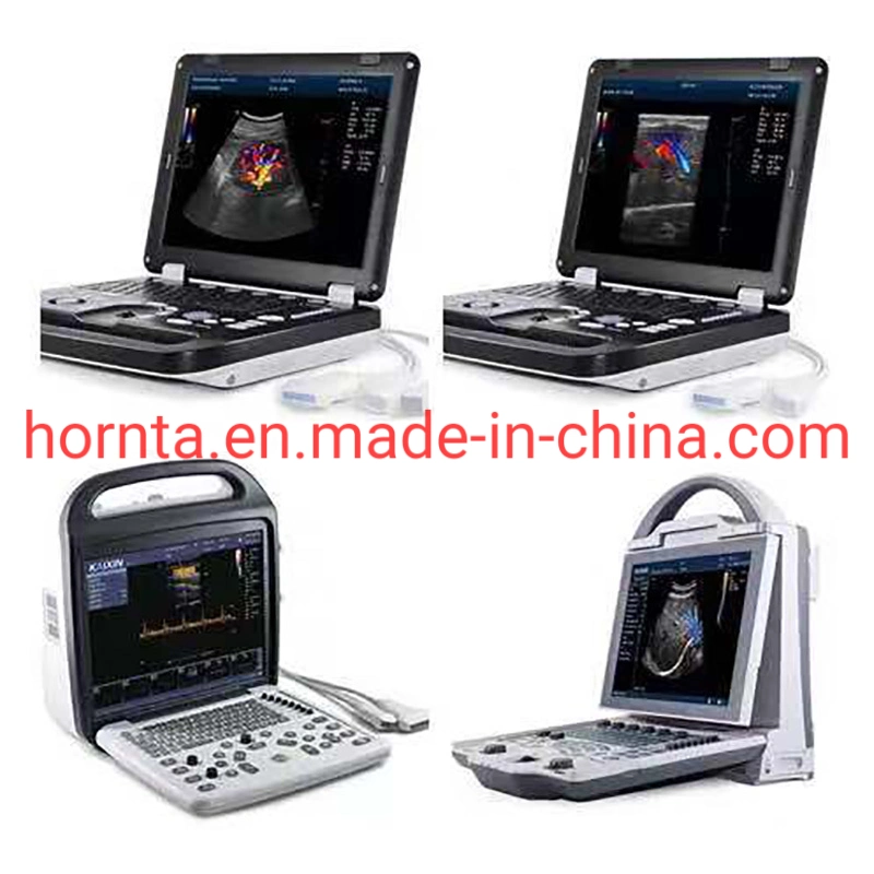 Dcu50 Color Doppler B-Ultrasound for Pig Cattle Horse Camel