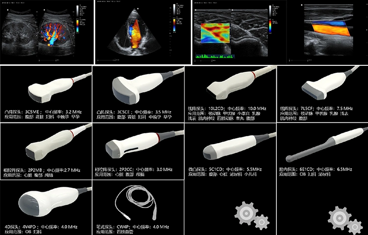 CE, ISO Imaging Diagnostic Equipment Laptop Medical Instruments Ultrasound Scan with Cheap Price
