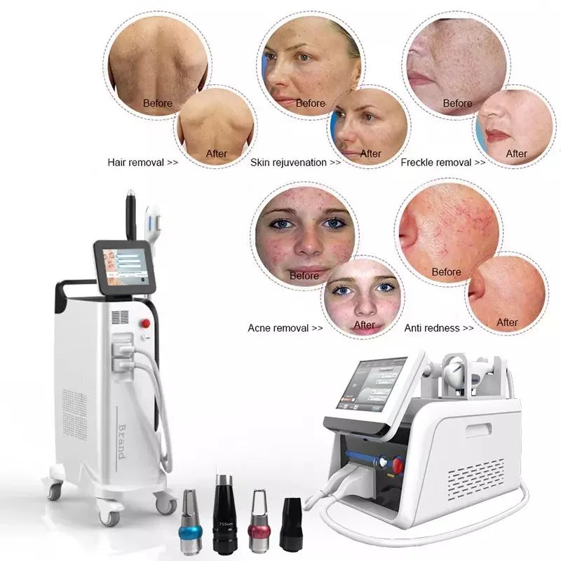 Gomecy Professional 2 em1 Opt Picolaser Dpl remoção de tatuagens Máquina Laser Máquina de remoção de pêlos a laser do Pico de rejuvenescimento da pele