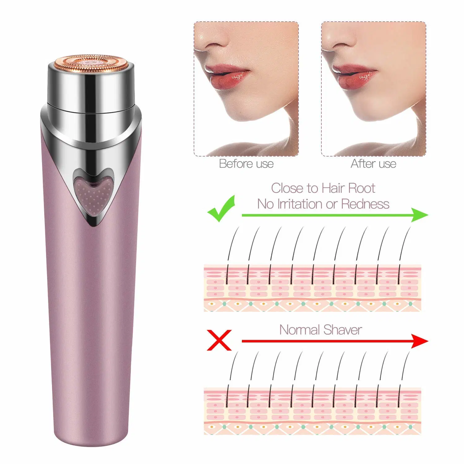 Patent Specially Strong Magnet Motor Safe and Painless Depilacion Lady Shaver Trimmer Electric Shaver Battery