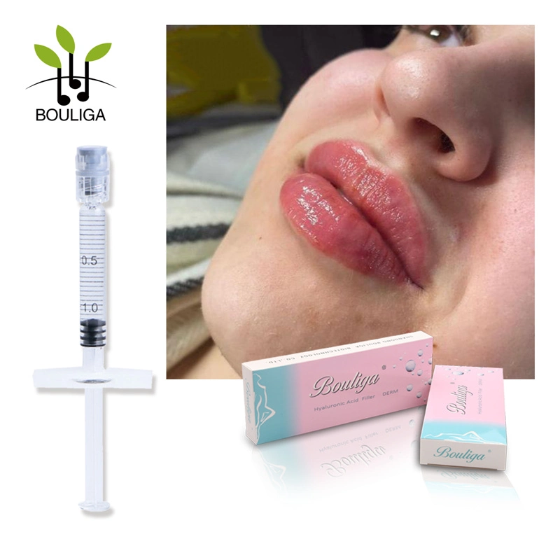 Bouliga 2ml Crosslinked relleno dérmico para labios mejorar