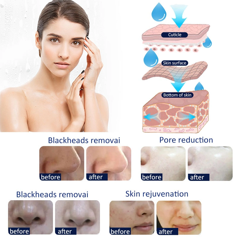 Centro de beleza New Skin Care facial Skin System Smart Ice Blue New Hydra Machine