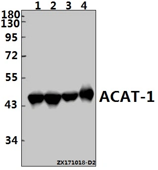 CE, la norme ISO9001 a approuvé l'Acat1 (K266) anticorps polyclonal