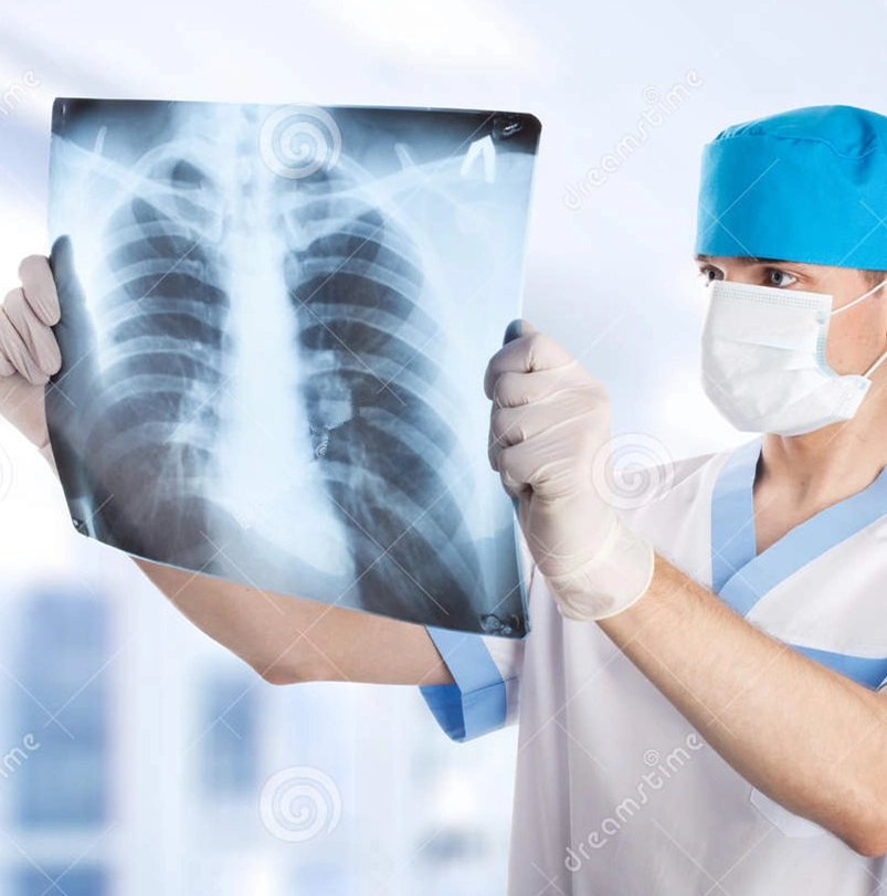 Le Pet Medical Inkjet Blue film à rayons X de la fabrication
