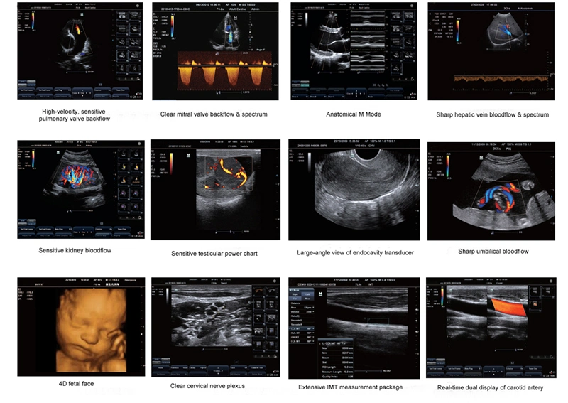 Система ультразвуковой визуализации в режиме 3D/4D с ЦДК, цифровая Sonography с большим медицинским светодиодным дисплеем