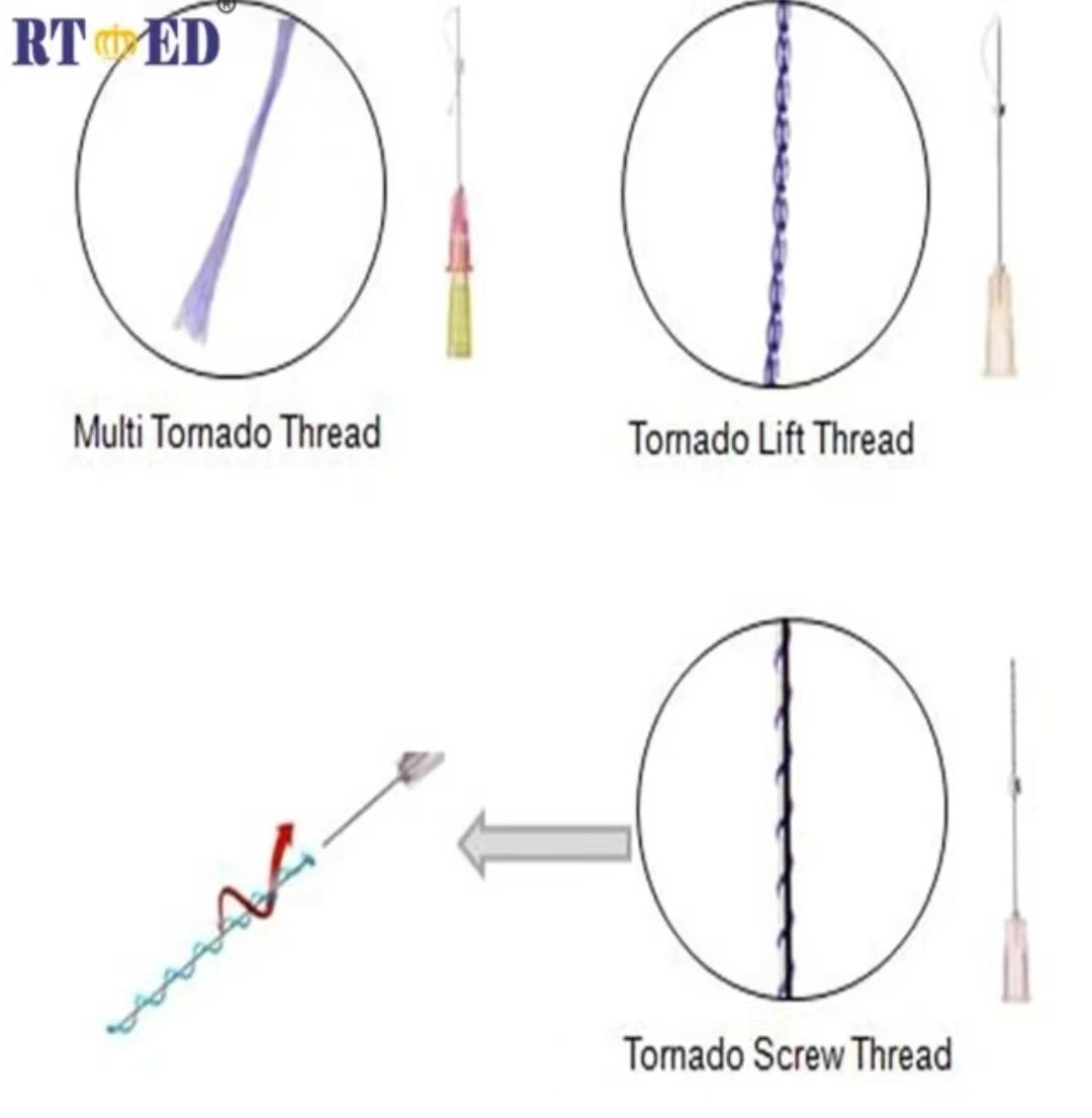 Tornado Screw 26g/27g Pdo Beauty Lifting Threads with Sharp Needle