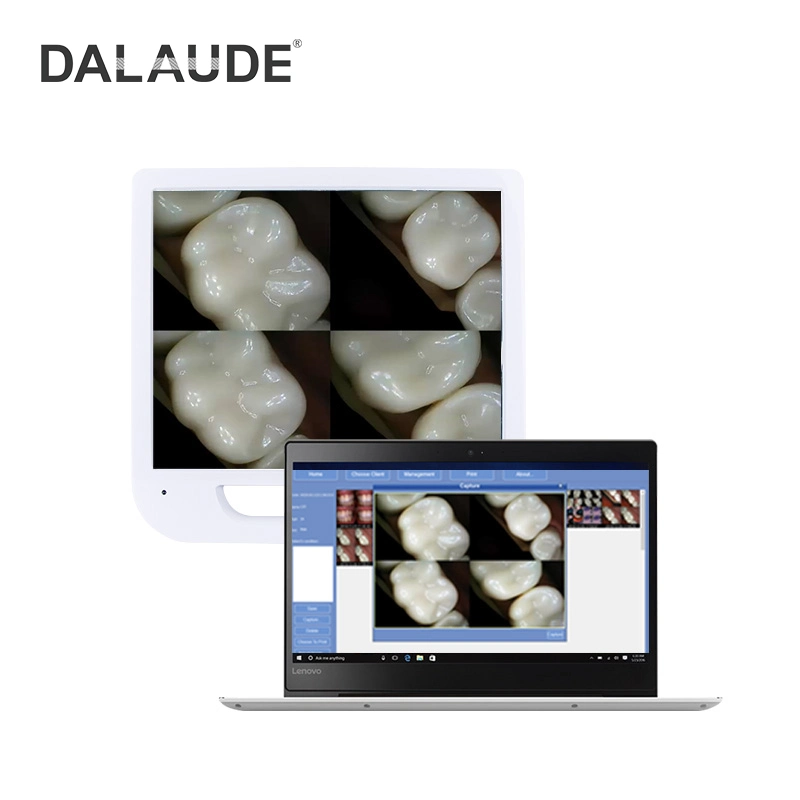 Mégapixels caméra dentaire clinique de l'endoscope Intraoral moniteur HD