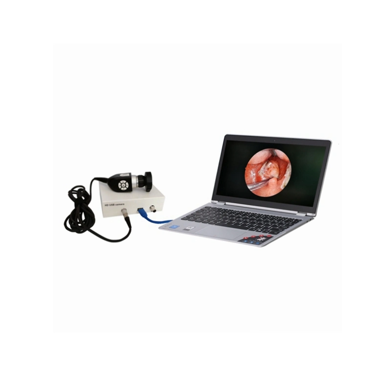 Best Selling Medical Endoscope USB Camera, Medical USB Camera