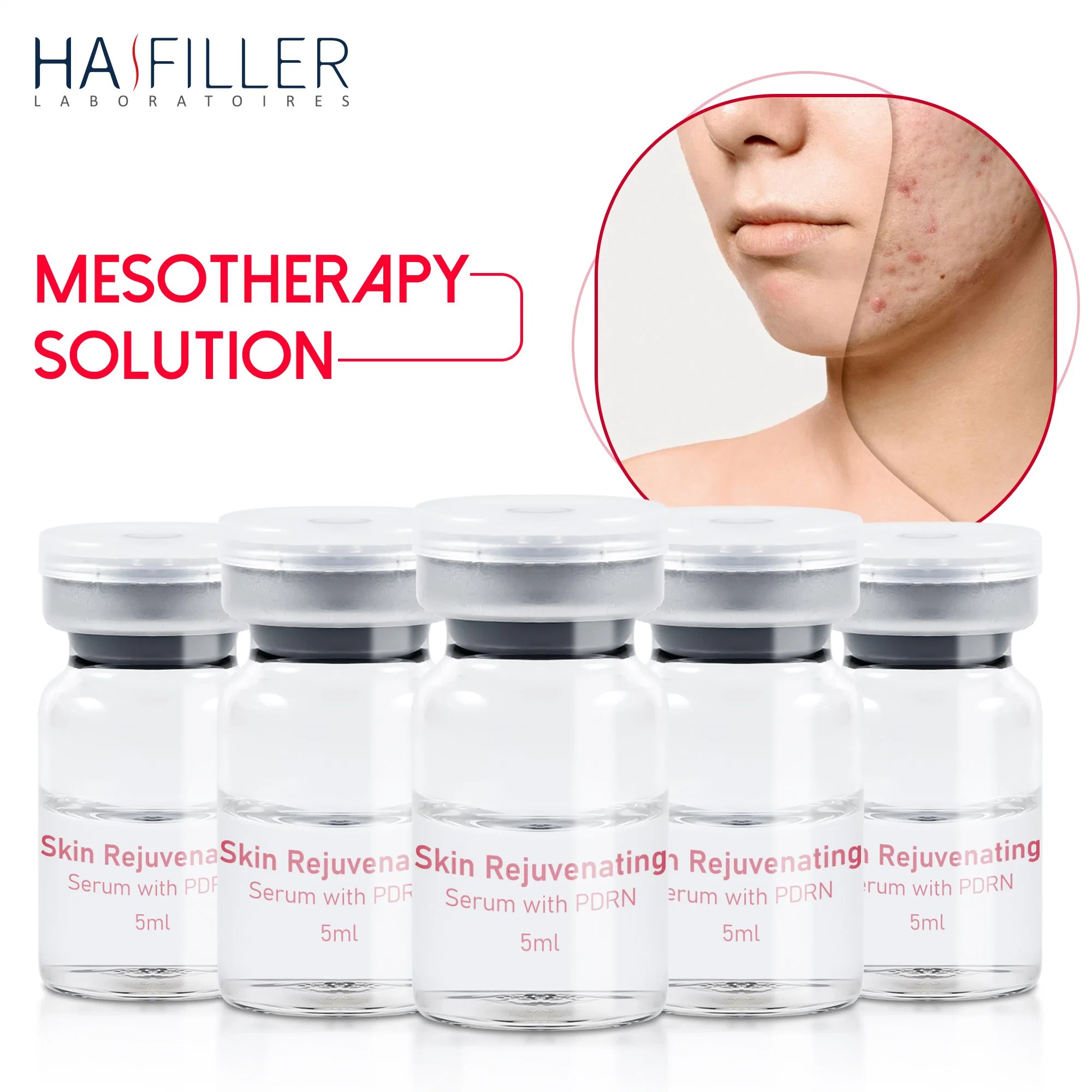 Hochwertige Gesichtshaut Straffende Aufhellung Hydrating Gesicht Haut Verjüngung Hyaluronsäure Injectable Pdrn Serum Mesotherapie