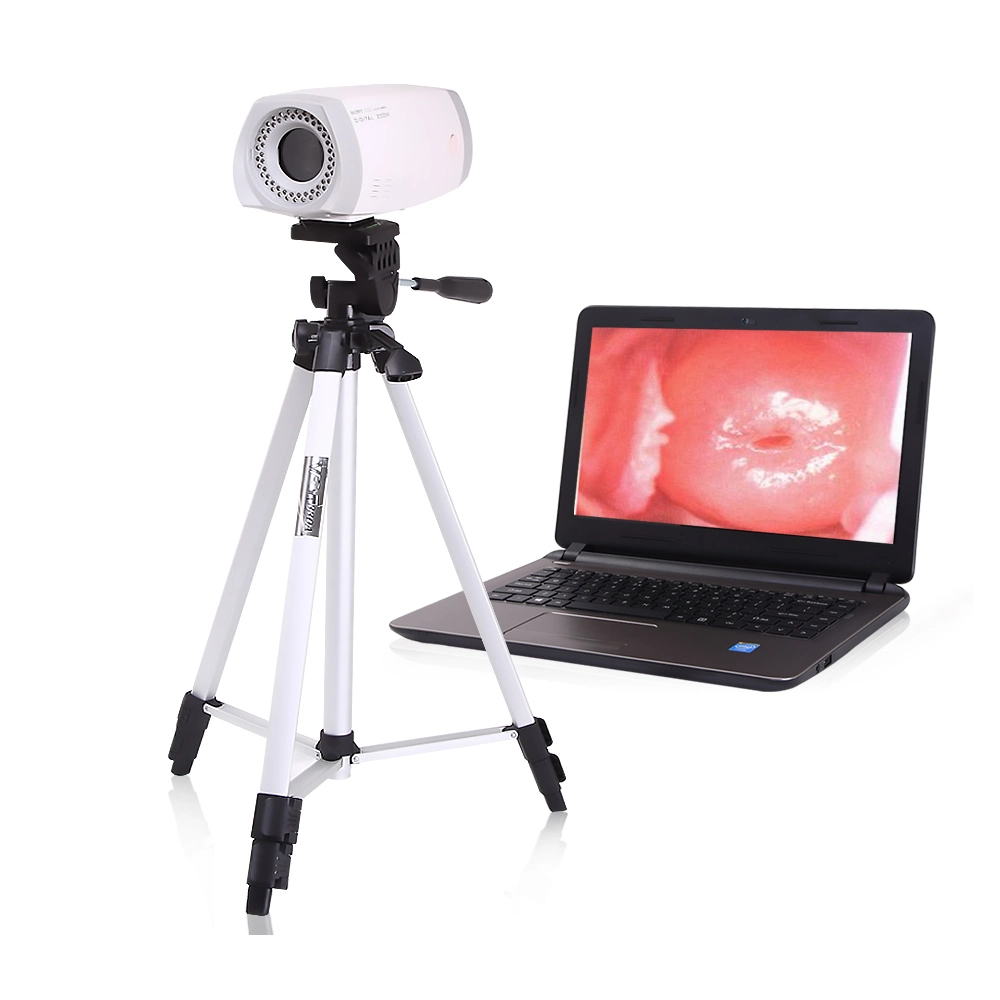 HD Digital Video Colposcope/Gyneology with Tripod