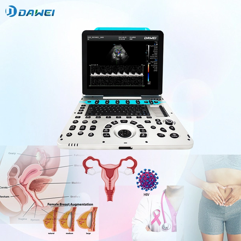 DW-P50 portable 5D Real Skin Doppler couleur échographie diagnostique Système