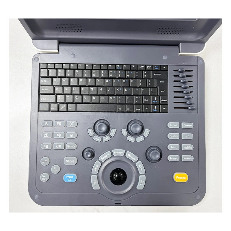 Sy-A042-1 High quality/High cost performance Clinic Medical Ultrasound Instrument Laptop Color Doppler Device