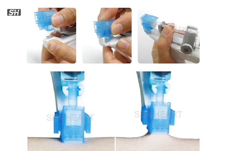 Wrinkle Removal Meso Gun Inject Needle 5 Pin Needle Mesotherapy Needle