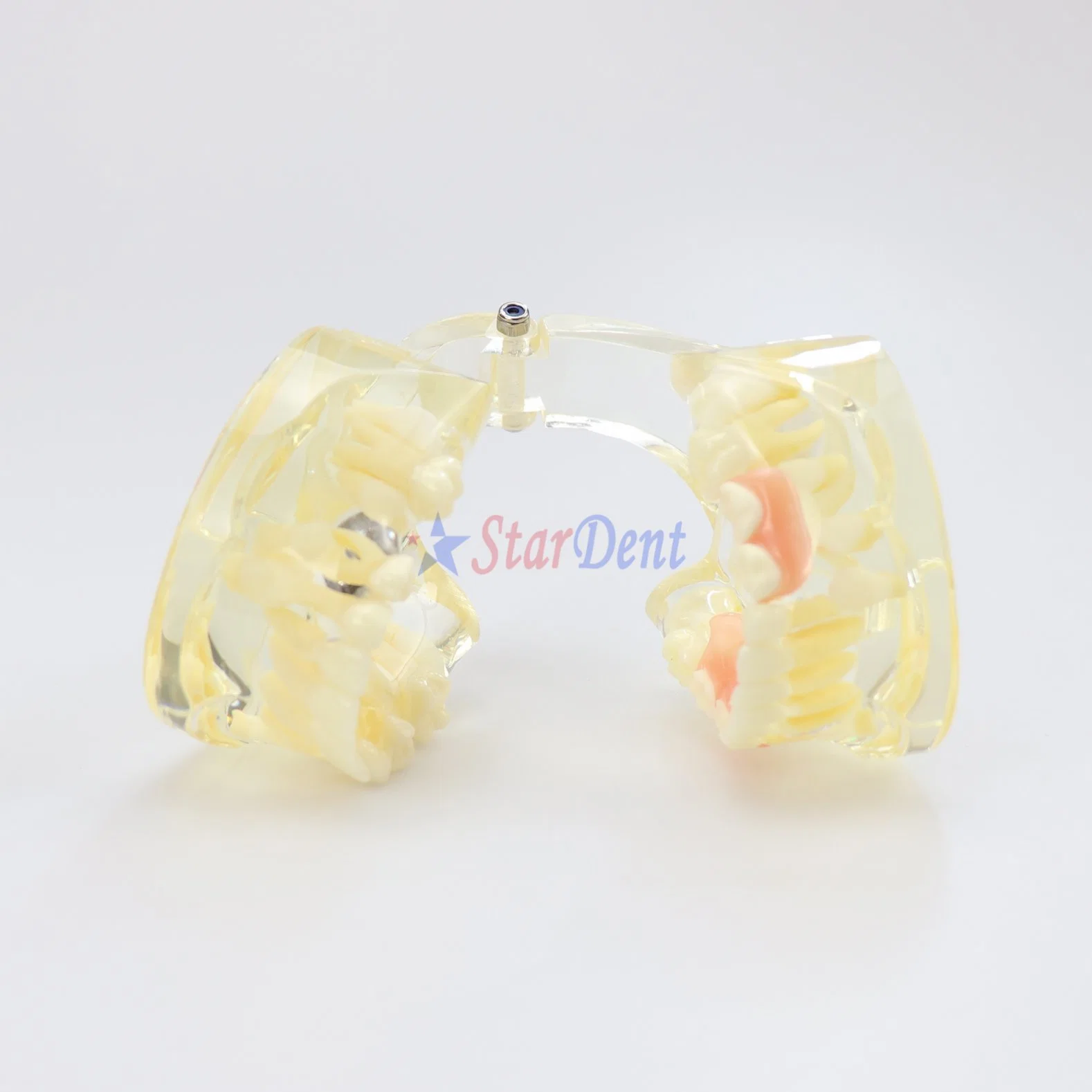 Dental Teeth Model with Removable Flipper Clear Mix Dentition Model for Teaching