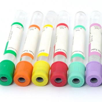 Various Non Vacuum Blood Collection Test Tube for Medical/Lab