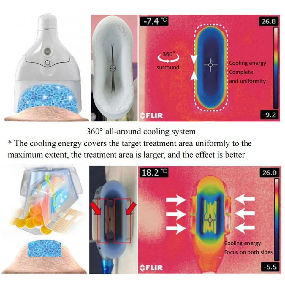 Cryoliolyse efficace machine à brûler les graisses pour les graisses glacées résistantes et indolores Équipement de retrait pour tous les types de peau