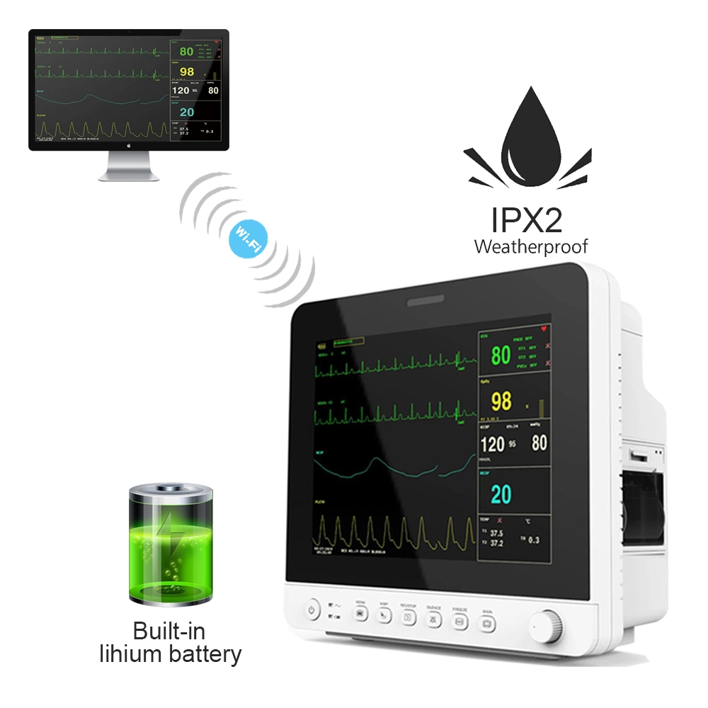 Monitor de paciente de ECG de 12 derivaciones Contec Cms8000-1 con certificado CE