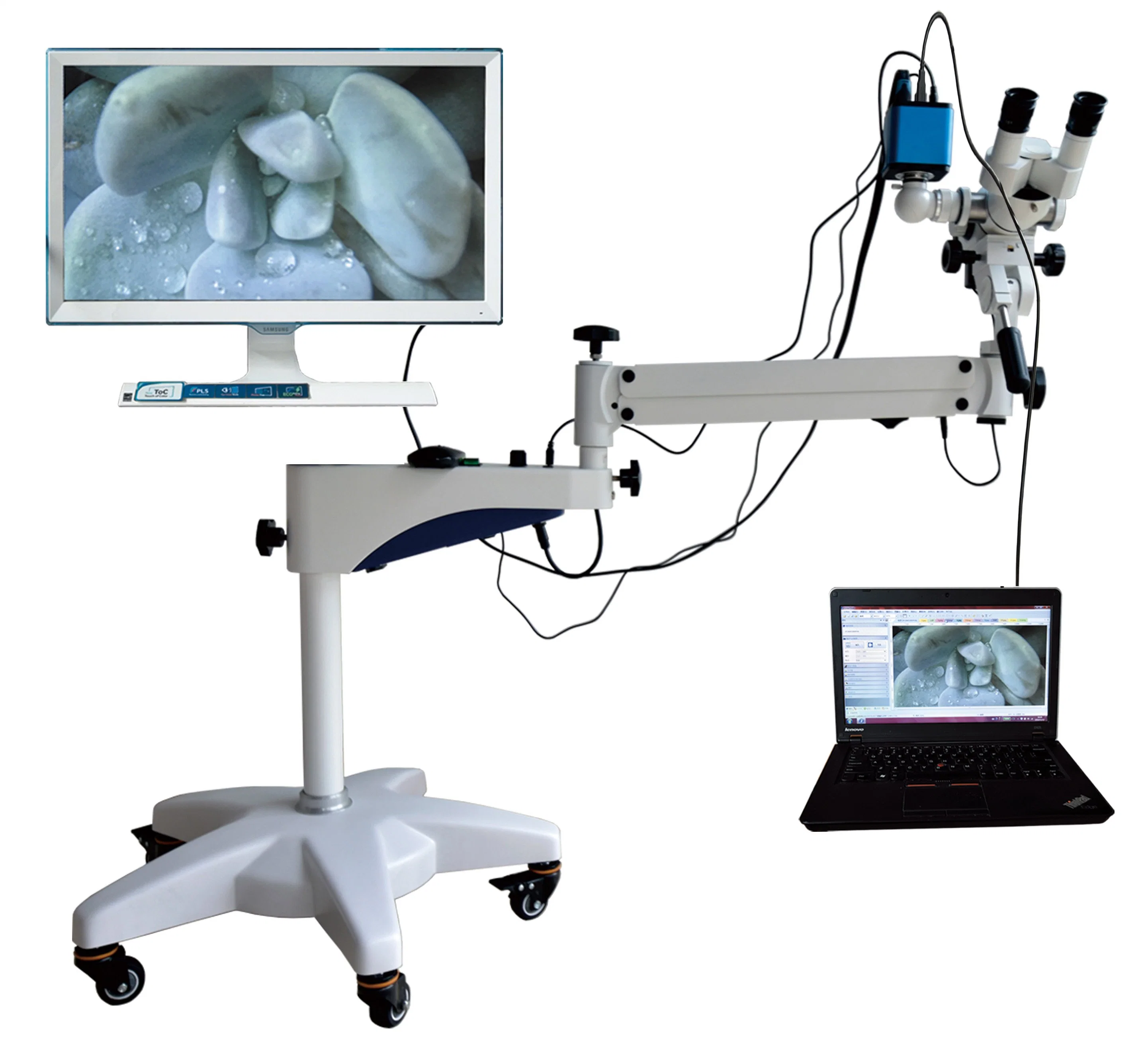 Optical Colposcope for Medical Vaginal Exam