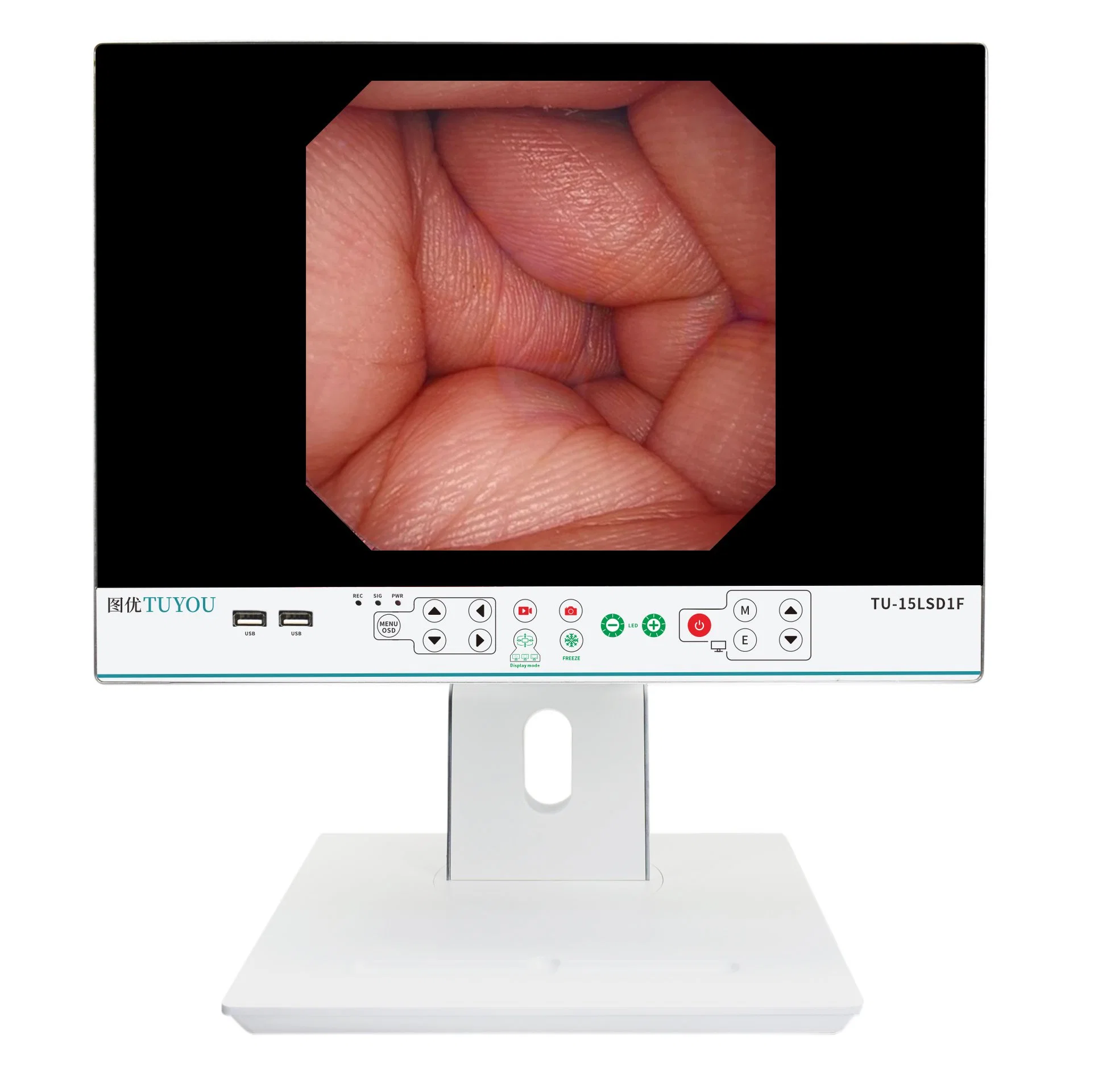 Tuyou Fuente de luz LED Monitor médico endoscopio portátil Cámara CMOS de la Unidad de Endoscopia