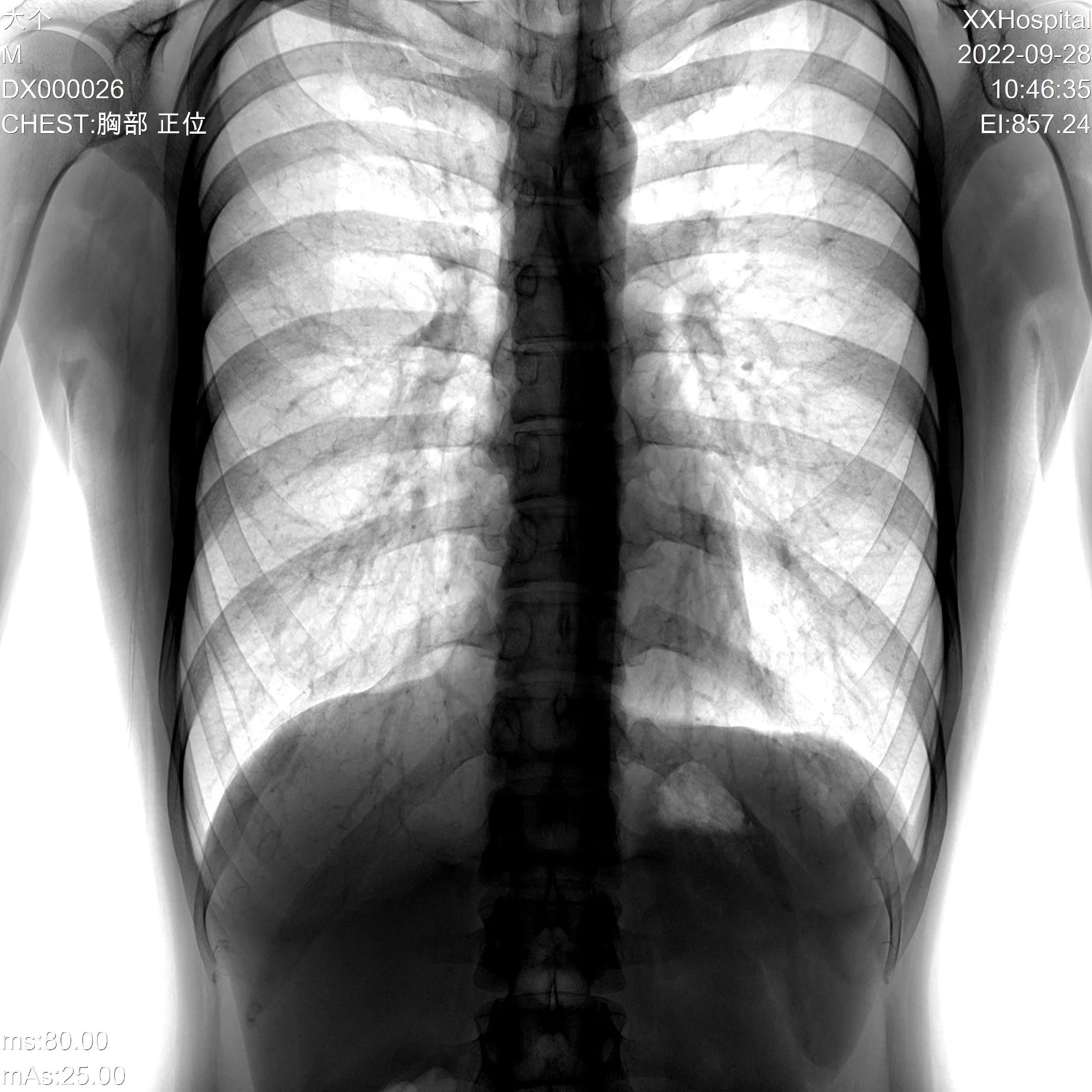 Sistema de radiografía digital China Rd-850X