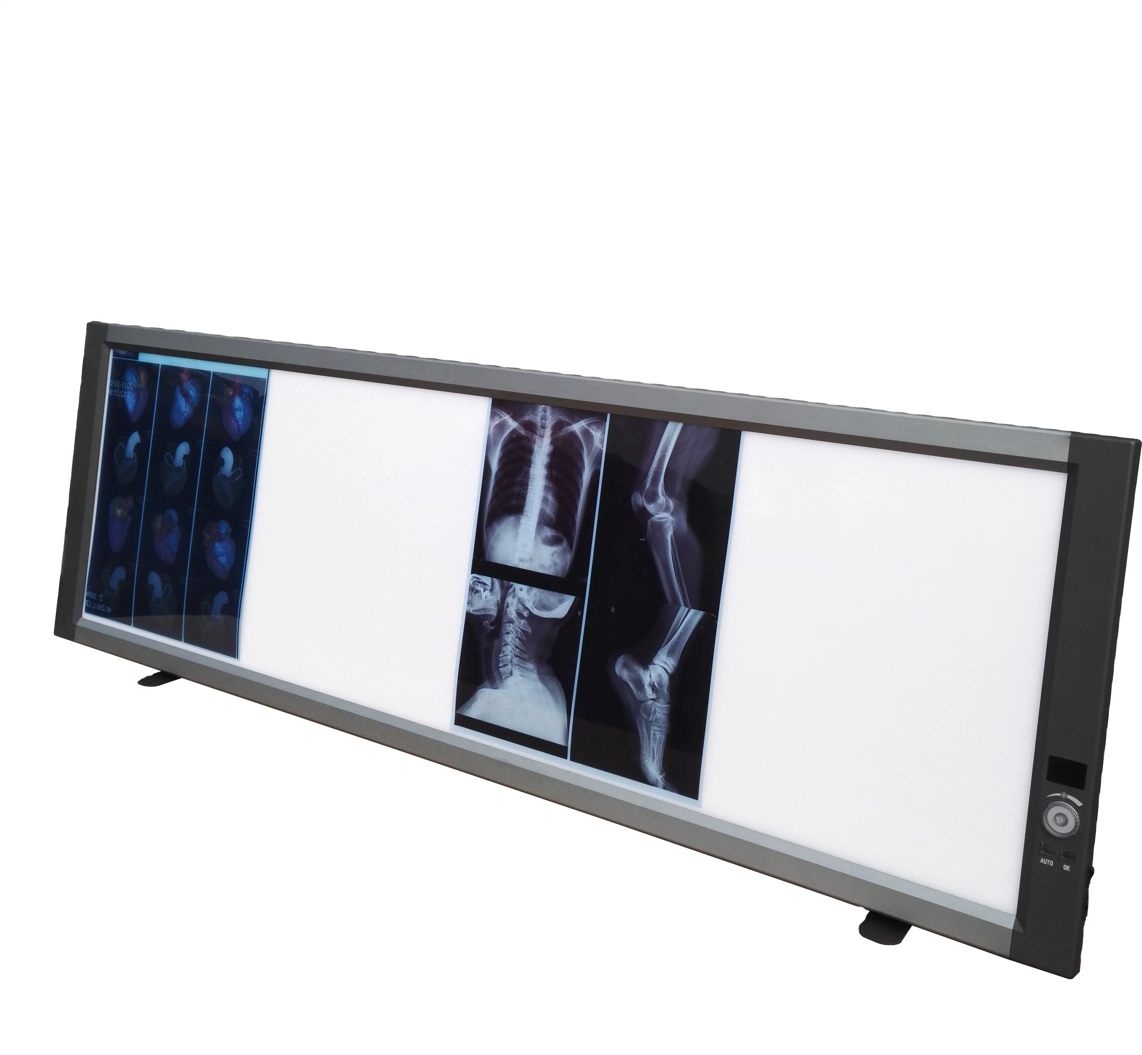 LED Viewing Box, X Ray Viewer, Negatoscope, Medical Film Viewer Double Screen Zg-3c