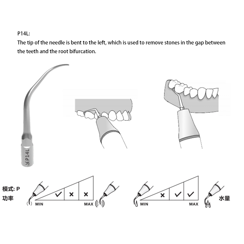 Zahnluft Scaler Tipps Entfernen Wurzel Bifurcation Steine Ultraschall Zahn Scaler P14L
