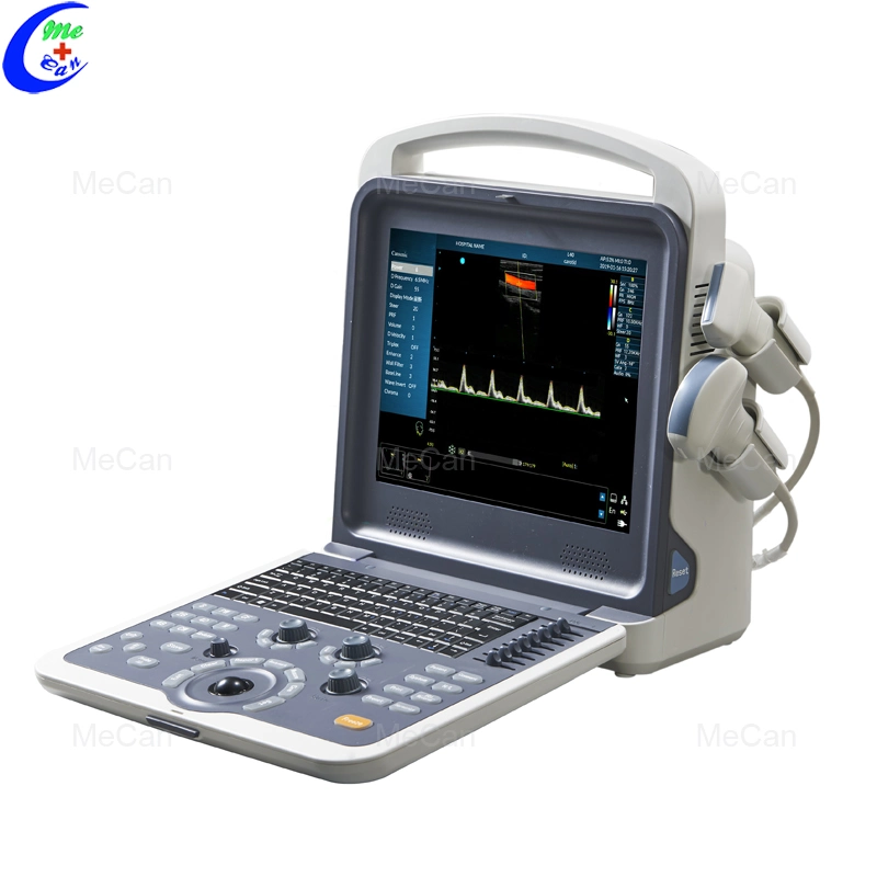 Full Digital Color Doppler Ultrasound Diagnostic System Portable Ultrasound