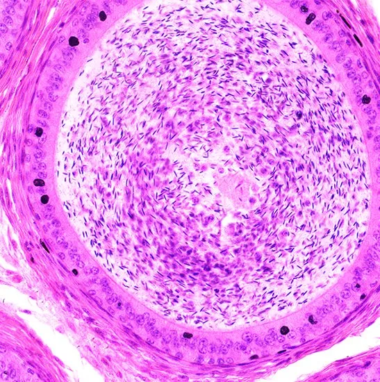 BestScope BS-2073T Laboratoire de recherche universitaire a conduit à l'infini de grossissement cinq bruit biological microscope trinoculaire