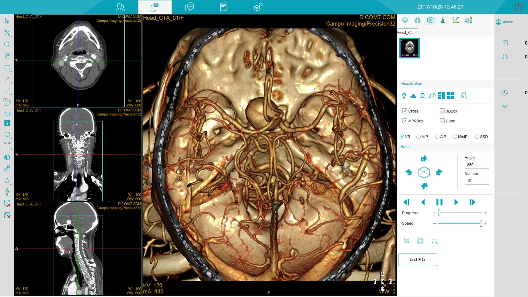 Fabricante CT Scanner MRI Pet 4 16 32 64 128 Equipo médico de Tomografía computarizada por cortes para uso hospitalario