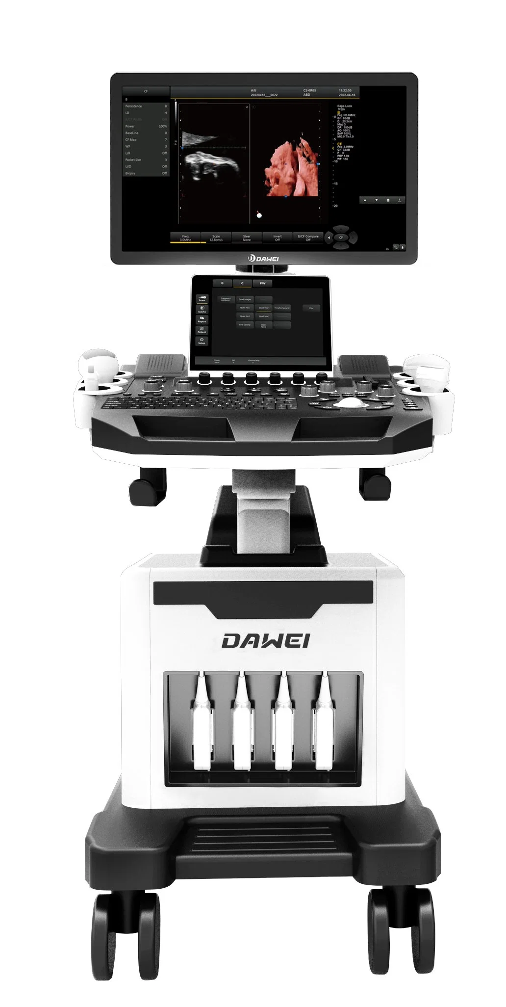 DW-T30 Dawei 3D/4D ecografía Doppler color opcional del hospital