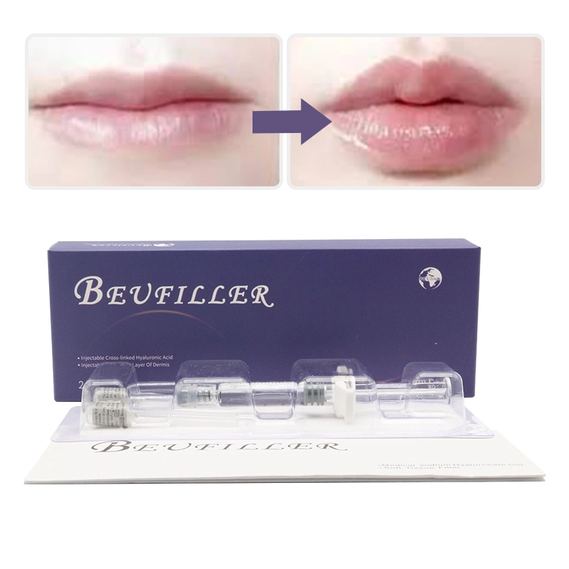 China Best Hot Selling 2ml Deep Derm Face Filler Lip Injection Hyaluronic Acid Dermal Filler