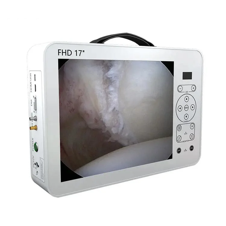 Medical Endoscope Camera and LED Light Source Integrative for Ent