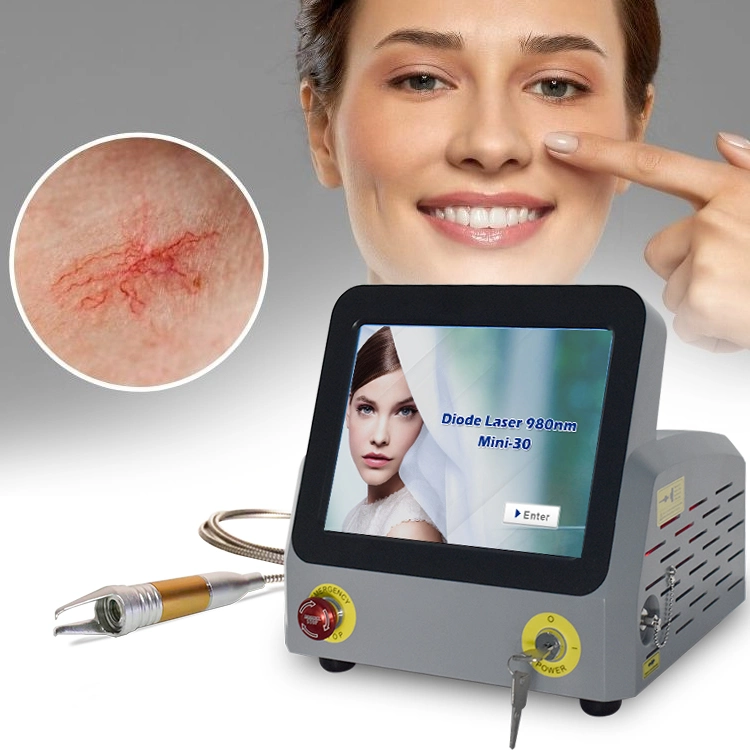 Медицинский лазер 60 Вт 980мм Spider Veins Vascular Machine Portable Non-Invasive Устройство для удаления сосудов Spider Vein