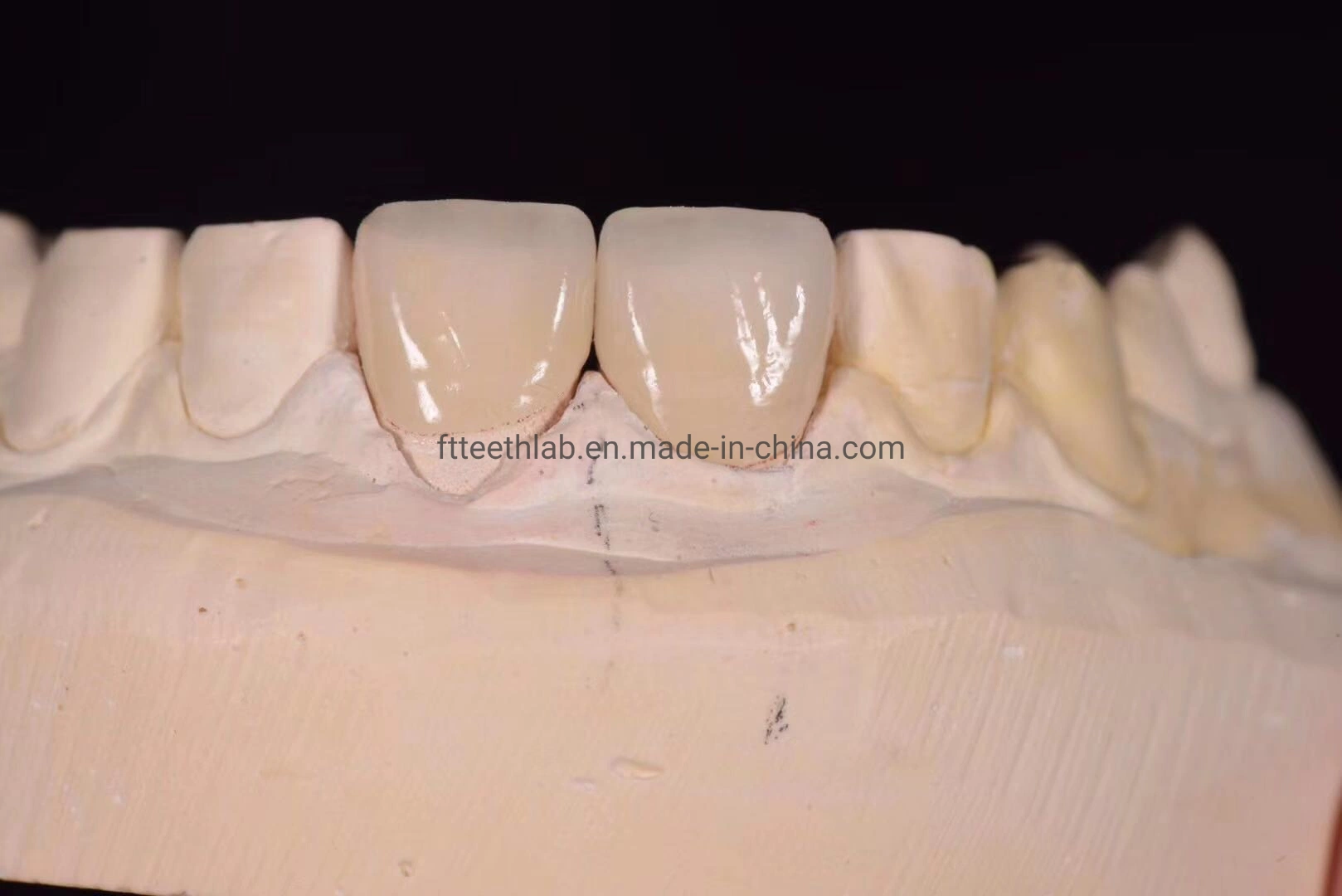 Material dentário coroa de Suprimentos Laboratório Dental Produtos Ortodontia ultra naturais folheados finos para sorriso perfeito