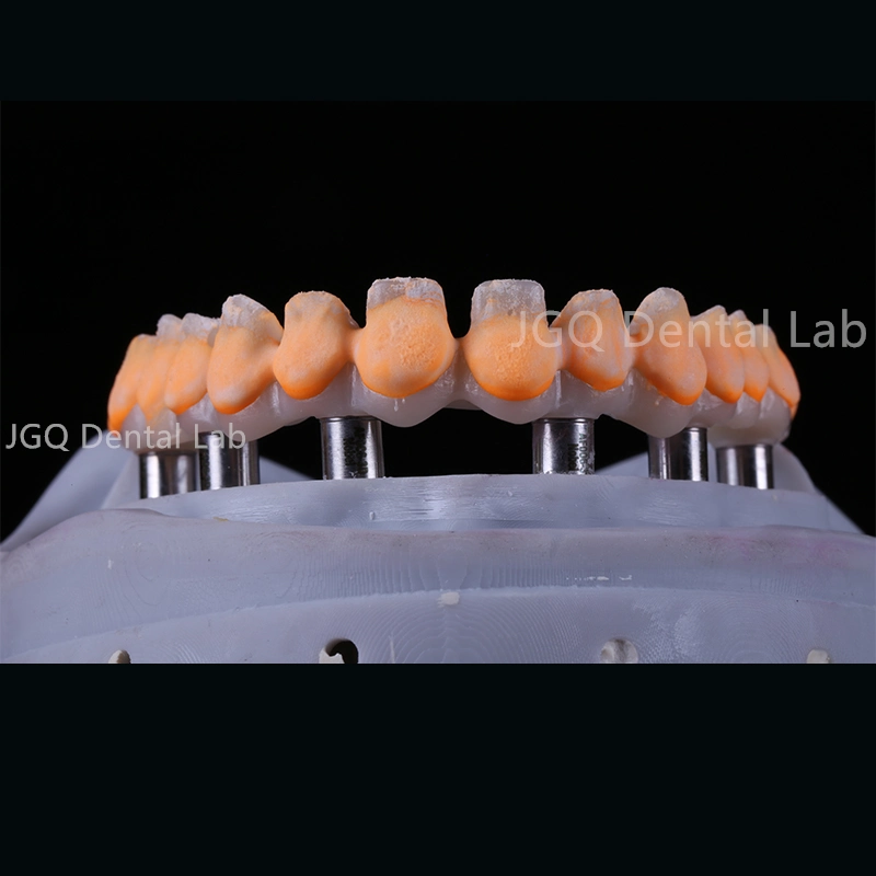 Dental Implant Customize Super Structure All-on-6 Full Contour Zirconia Dental Implant Bridge