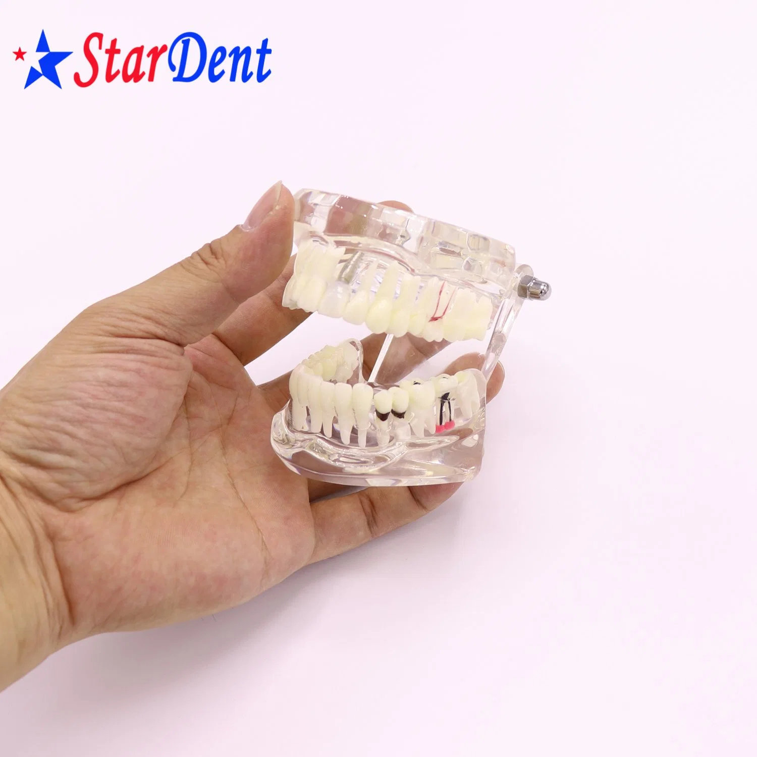 Transparent Adult Pathology Dental Model, Dental Teaching Model Teeth Model