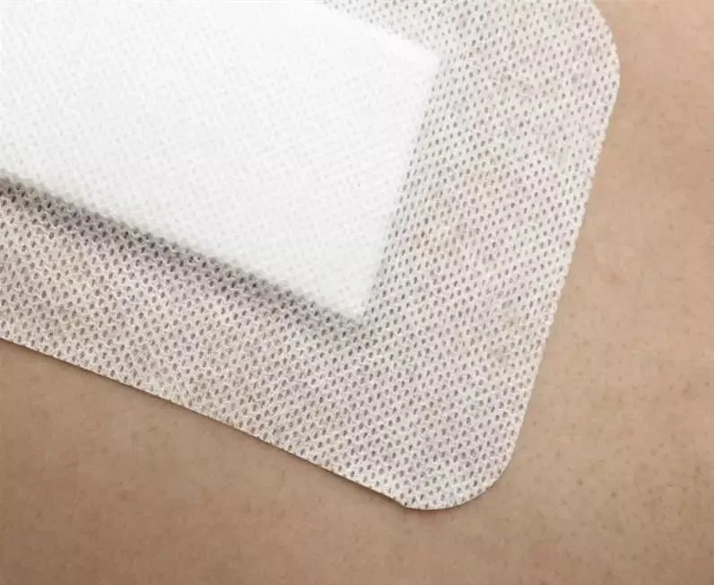 Adhesive Non-Woven White Color Infusion Stick Medical Wound Dressing Roll