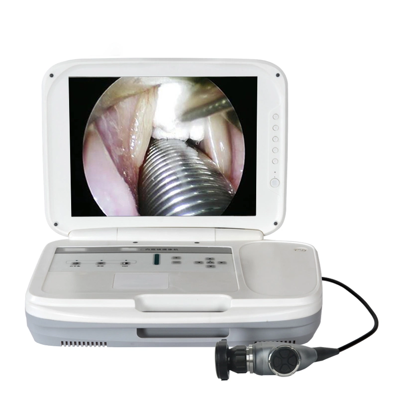 Factory Nasal Flexible AV USB 6mm Portable Nose Endoscope Endoscopic Camera System