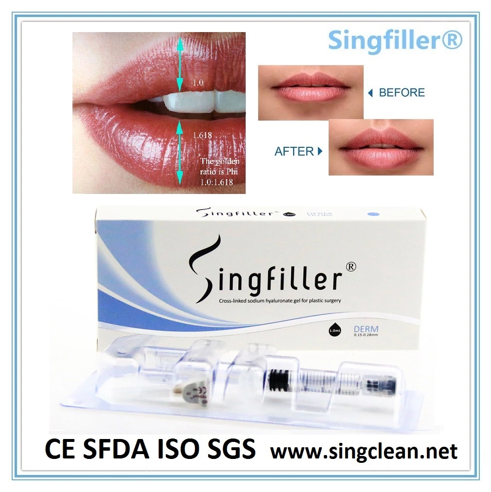 Los adultos Sfda Singfiller jeringa precargada en estuche de gel de Hialuronato de Sodio