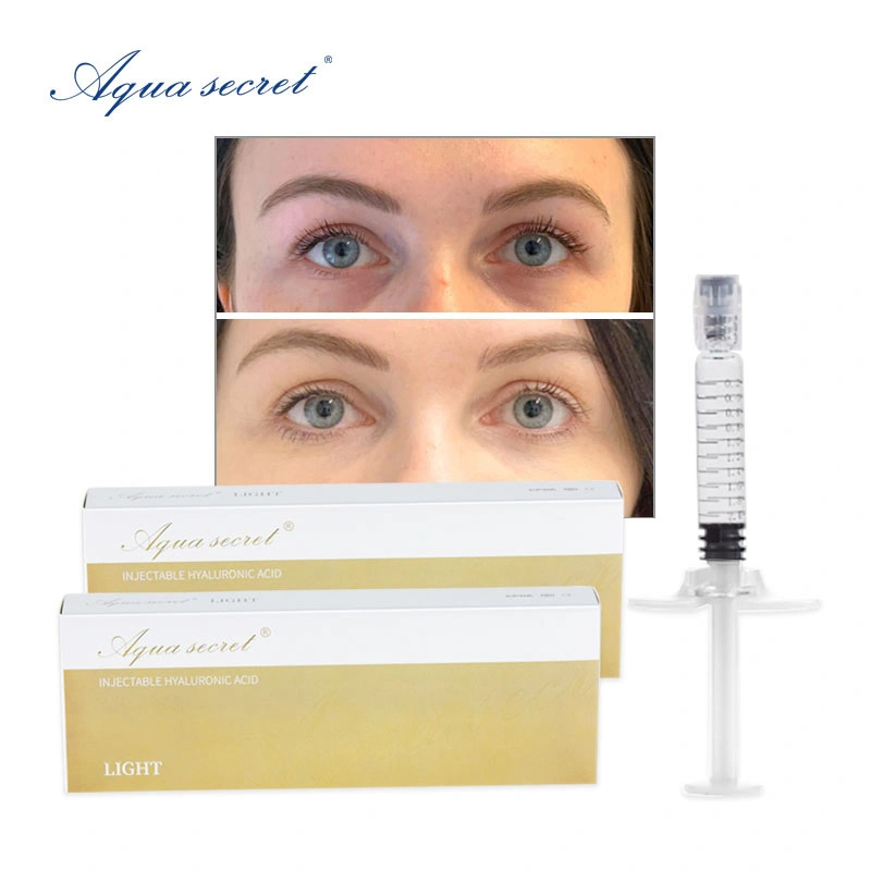 Aqua secreto 1ml de 2ml Face Revolax relleno dérmico de inyección en línea Facial labios