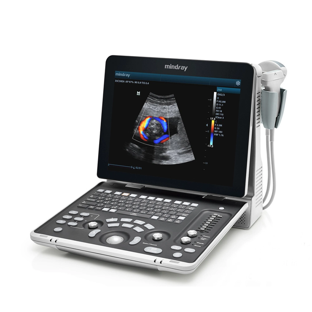 Hot Sales Mindray Z50 Color Doppler Ultrasound Diagnosis Ultrasound For Hospital Clinic