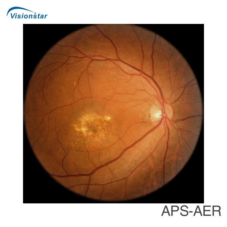 with Ce FDA Approved Fundus Camera