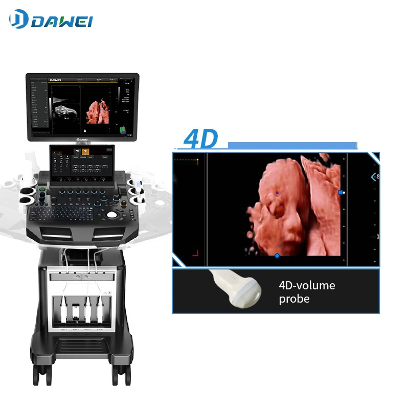 4D 5D Large Screen Color Doppler Ultrasonic Machine USG Machine Dw-T30