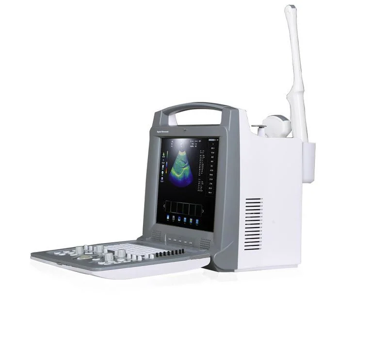 Hospital Medical Máquina portátil Doppler Color 3D Ecografía Systerm/Escáner/Equipo.